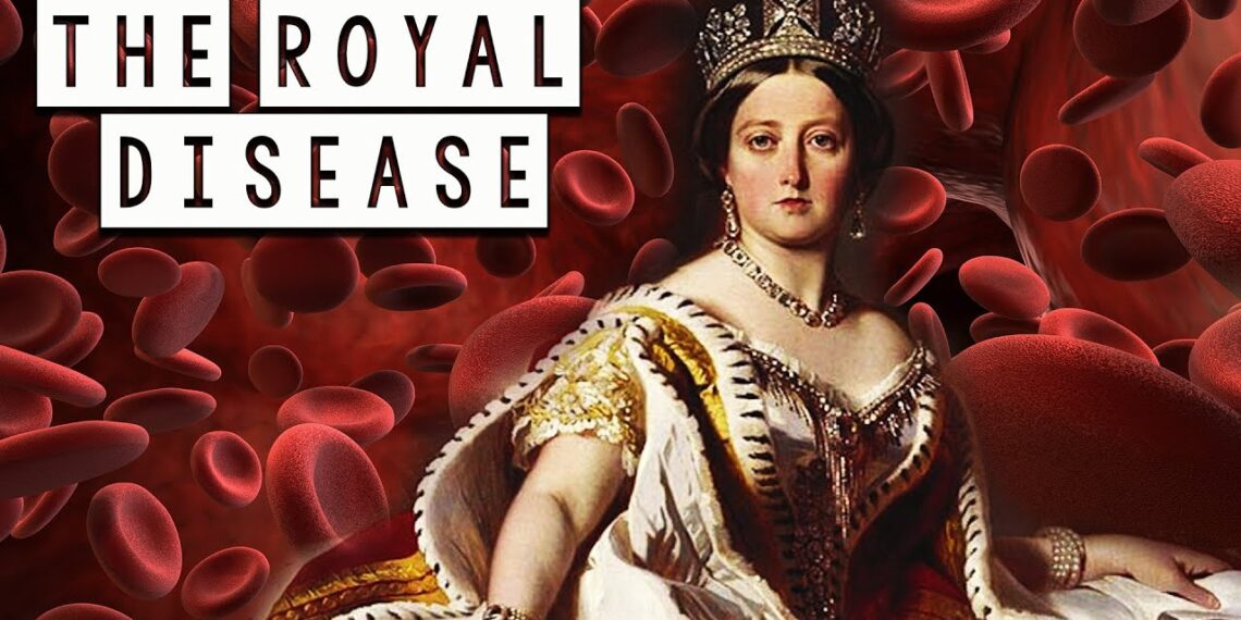 Hemophilia_Royal-Disease